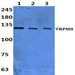 Bs60452_wb