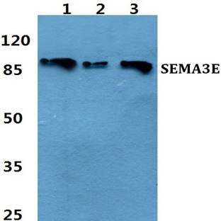 SEMA3E pAb