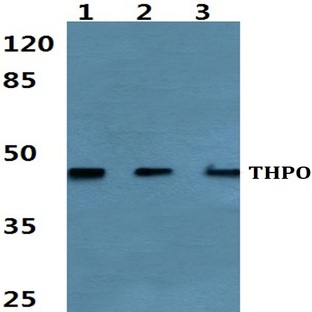 Thrombopoietin pAb