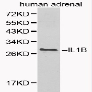 IL-1(beta) pAb
