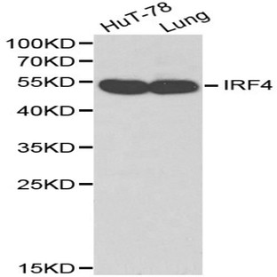 IRF-4 pAb