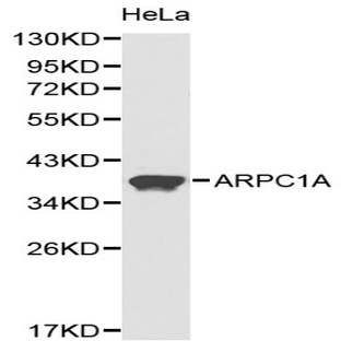 ARPC1A pAb