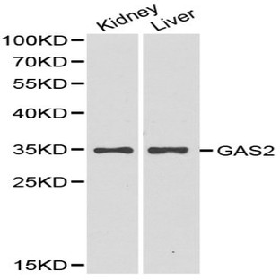 GAS2 pAb