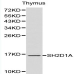 Bs6174_wb