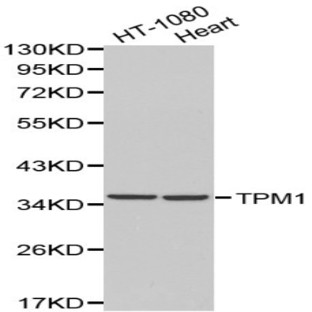 Tropomyosin (alpha) pAb