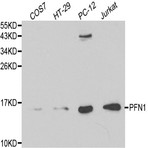 PFN1 pAb