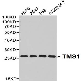 TMS1 pAb