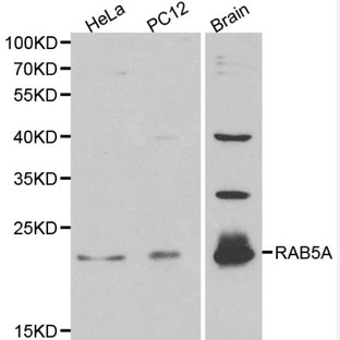 RAB5A pAb