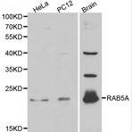 RAB5A pAb