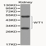 Bs6239_wb