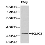 PSA/KLK3 pAb