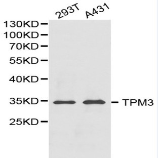 TPM3 pAb