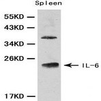 IL-6 pAb