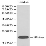 IFN-(alpha) pAb