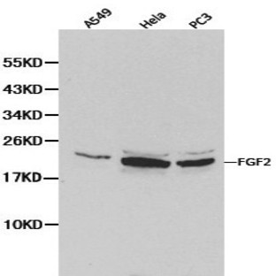 FGF Basic (FGF2 ) pAb