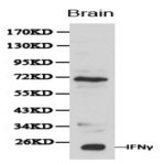 IFN-(gamma) pAb