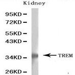 Bs6449_wb