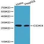 CDK4 pAb