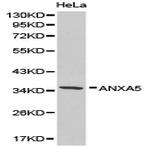 Annexin 5 pAb