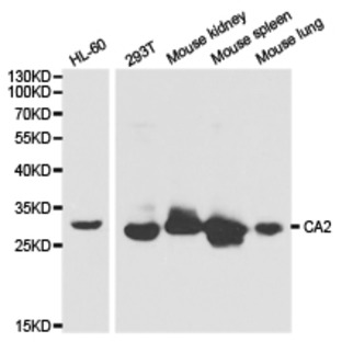 CA II pAb