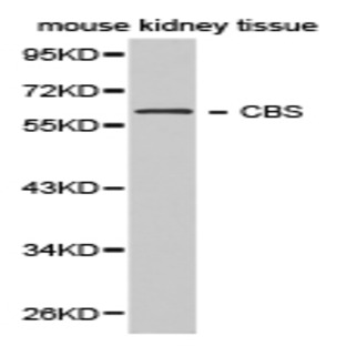 CBS pAb