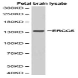 ERCC5 pAb