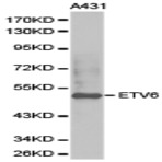 TEL/ETV6 pAb