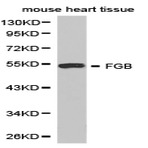 Fibrinogen (beta) / FGB pAb