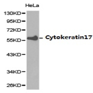 Cytokeratin 17 pAb