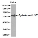 Cytokeratin 17 pAb