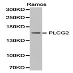 PLC (gamma)2 pAb