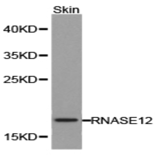 RNASE12 pAb