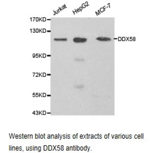 DDX58 pAb