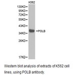 DNA pol (beta) pAb