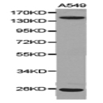 Integrin (alpha)V pAb