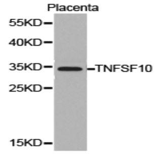 TRAIL/ TNFSF10 pAb