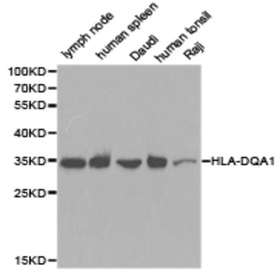 HLA-DQA1 pAb