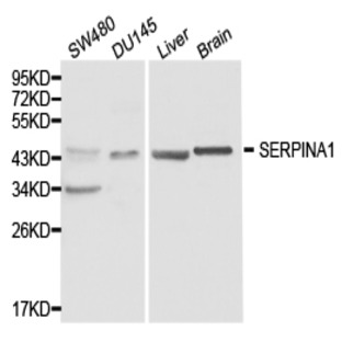 SERPINA1 pAb