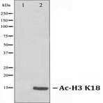 Ac-Histone H3 (K18) pAb