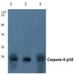 Caspase-6 p18 (D179) pAb