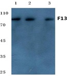 Factor 13 A (G39) pAb