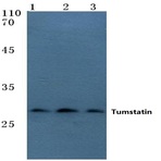 Collagen 4A3 (Tumstatin) pAb