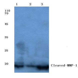 Cleaved-MMP-1 (P270) pAb