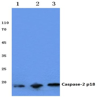 Caspase-2 p18 (T325) pAb