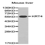 Cytokeratin 4 pAb