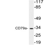 CD79a (T203) pAb