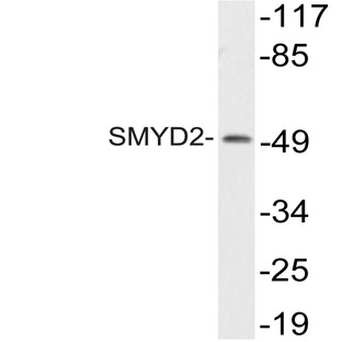 SMYD2 (L148) pAb