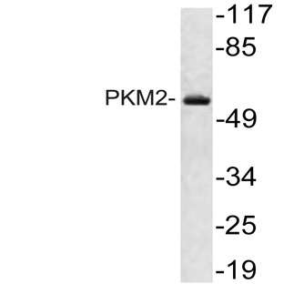 PKM2 (K230) pAb