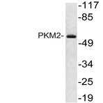 PKM2 (K230) pAb