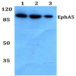 EphA5 (Y515) pAb